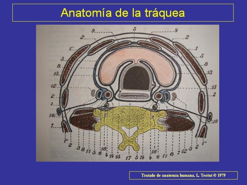 Diapositiva 13 de Anatomía del Árbol Traqueo-bronquial