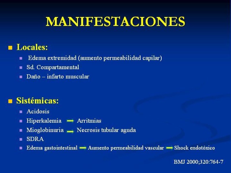 Diapositiva 4 de SD. Reperfusión