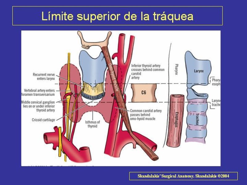 Diapositiva 2 de Anatomía del Árbol Traqueo-bronquial