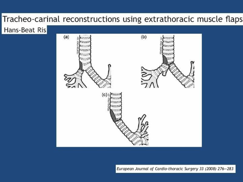 Diapositiva 38 de Estenosis laringo-traqueal pt. II