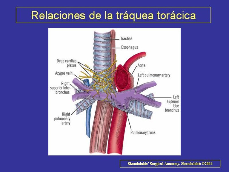 Diapositiva 16 de Anatomía del Árbol Traqueo-bronquial