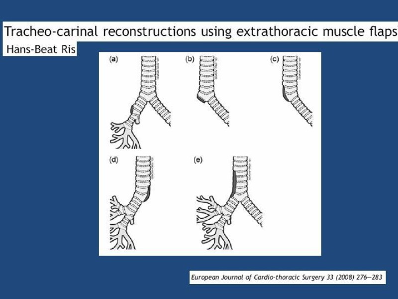 Diapositiva 37 de Estenosis laringo-traqueal pt. II