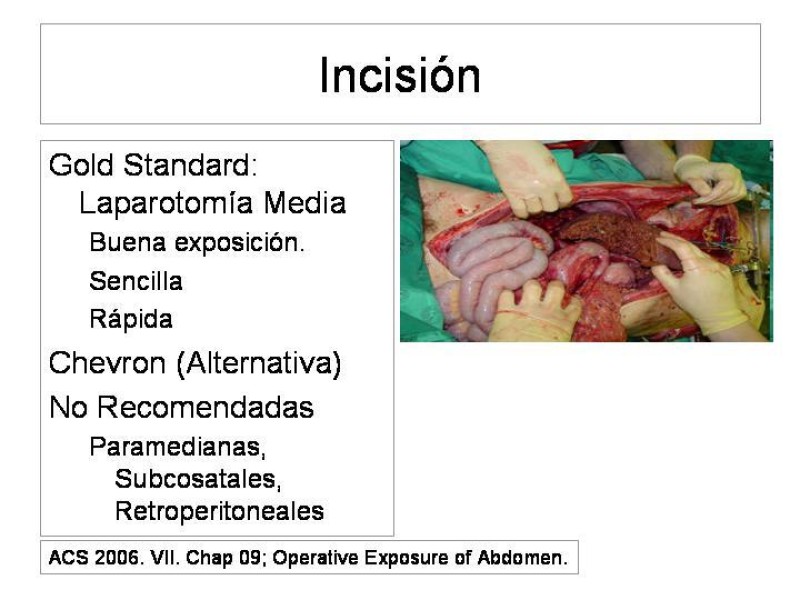 Diapositiva 4 de Maniobras Quirúrgicas de Exposición Abdominal