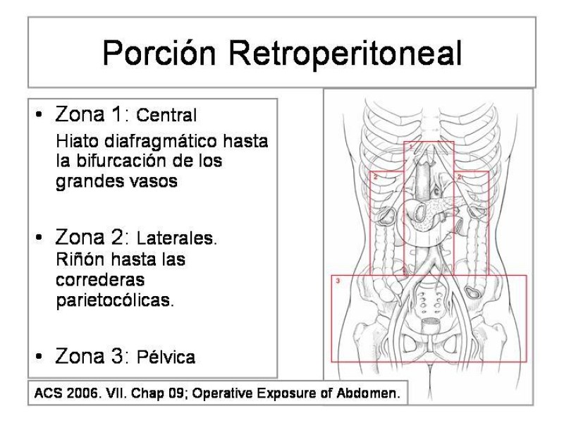 Diapositiva 7 de Maniobras Quirúrgicas de Exposición Abdominal