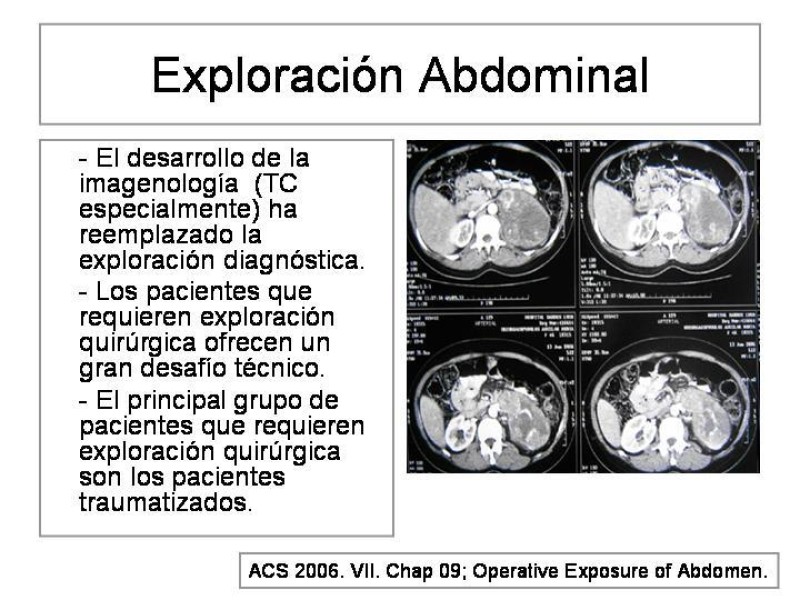 Diapositiva 1 de Maniobras Quirúrgicas de Exposición Abdominal