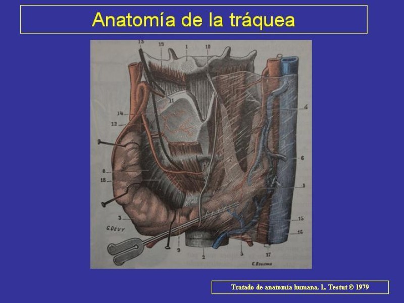 Diapositiva 11 de Anatomía del Árbol Traqueo-bronquial