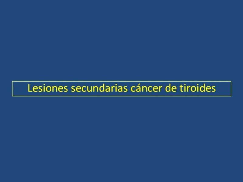 Diapositiva 26 de Estenosis laringo-traqueal pt. II
