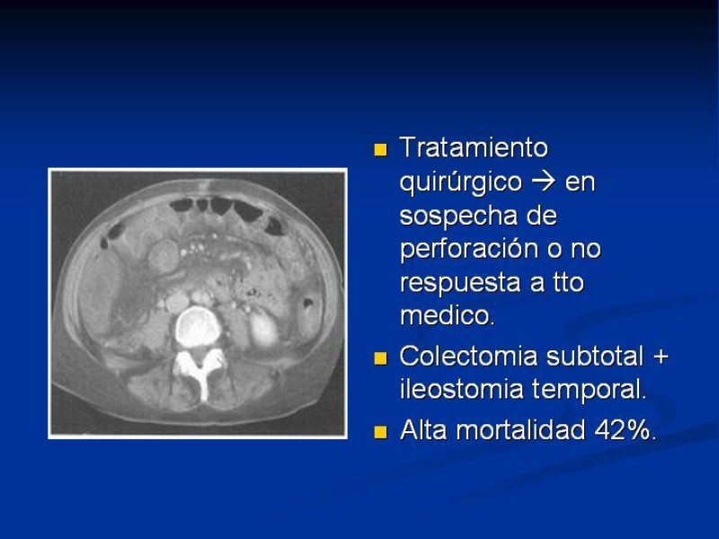 Diapositiva 23 de Infección Asociada a Clostridium Difficile