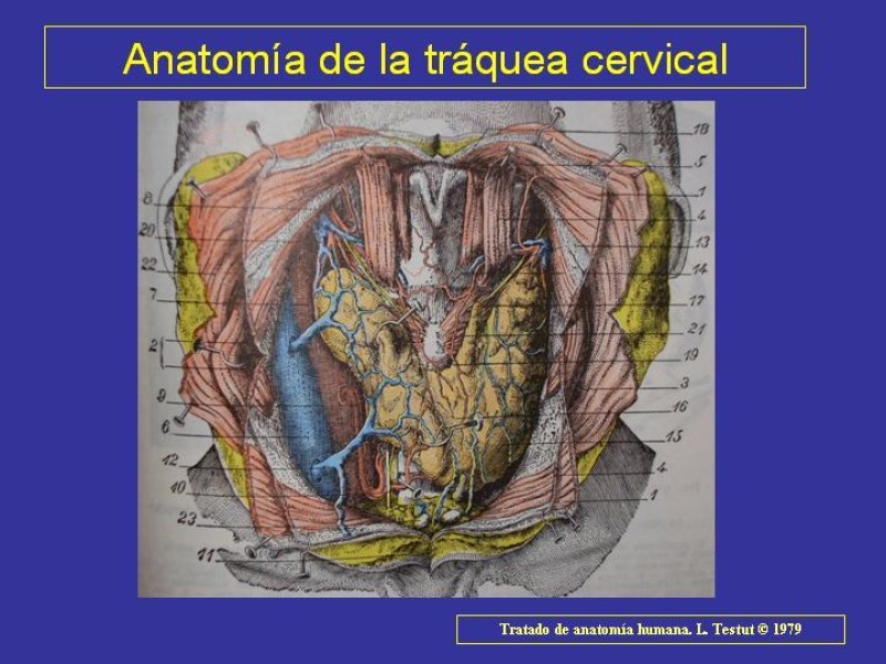 Diapositiva 8 de Anatomía del Árbol Traqueo-bronquial
