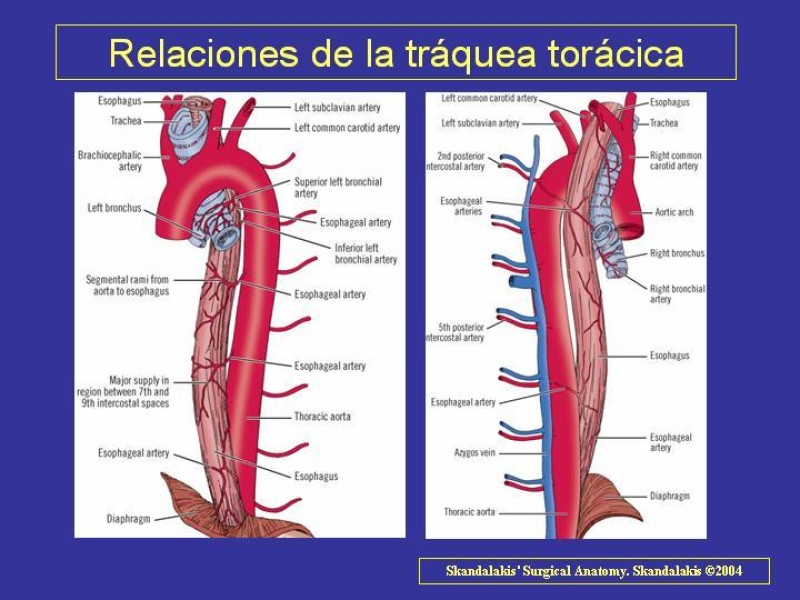Diapositiva 17 de Anatomía del Árbol Traqueo-bronquial
