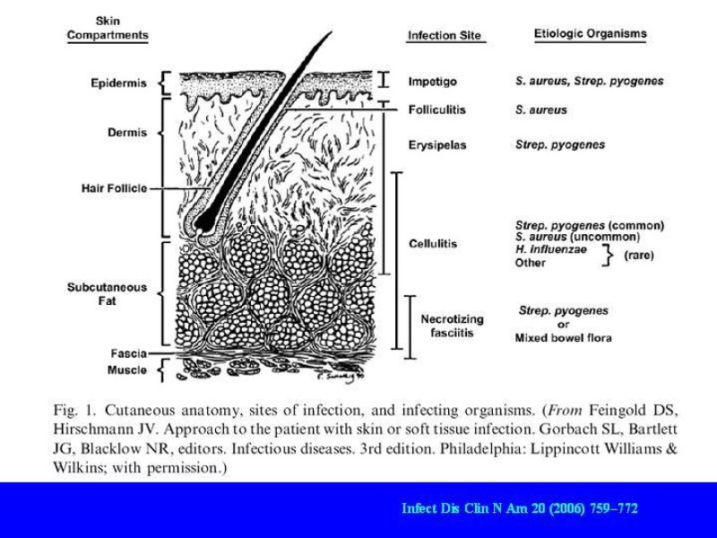 Diapositiva 2 de Infecciones Necrotizantes