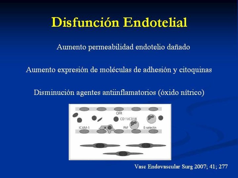Diapositiva 7 de SD. Reperfusión