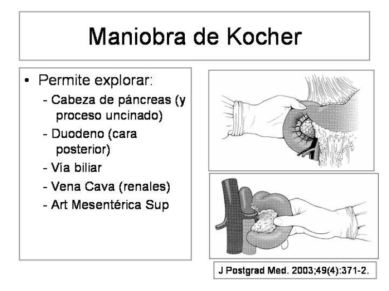 Diapositiva 11 de Maniobras Quirúrgicas de Exposición Abdominal