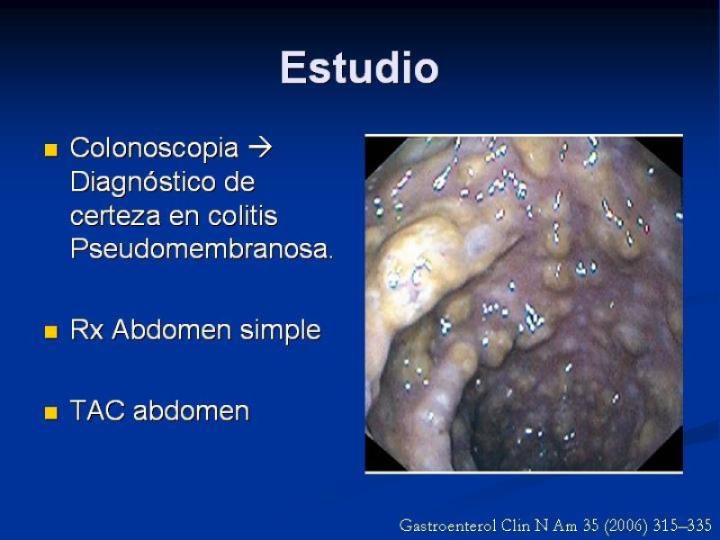 Diapositiva 11 de Infección Asociada a Clostridium Difficile