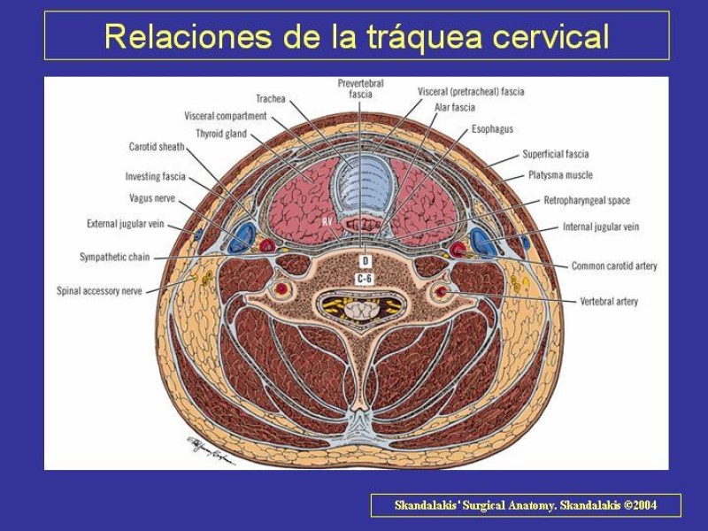 Diapositiva 6 de Anatomía del Árbol Traqueo-bronquial