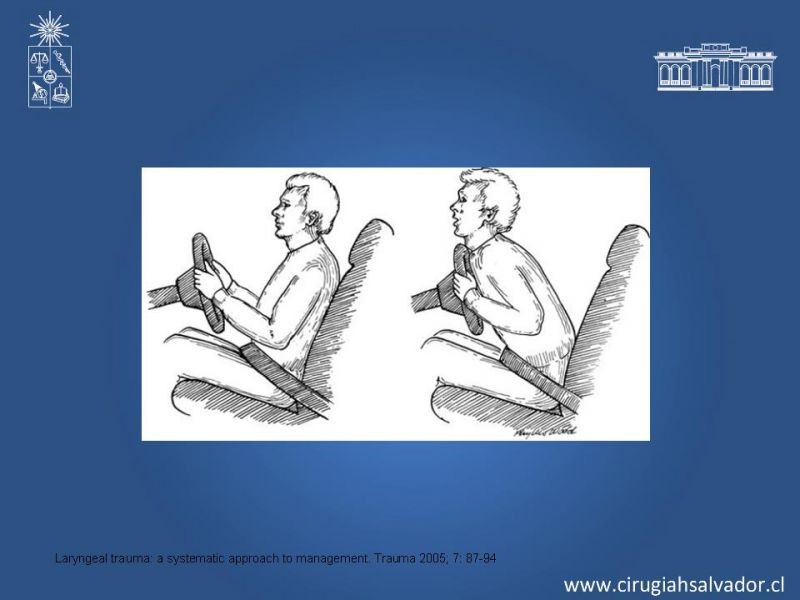 Diapositiva 5 de Manejo del trauma laríngeo