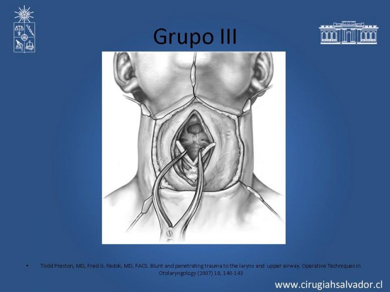 Diapositiva 15 de Manejo del trauma laríngeo