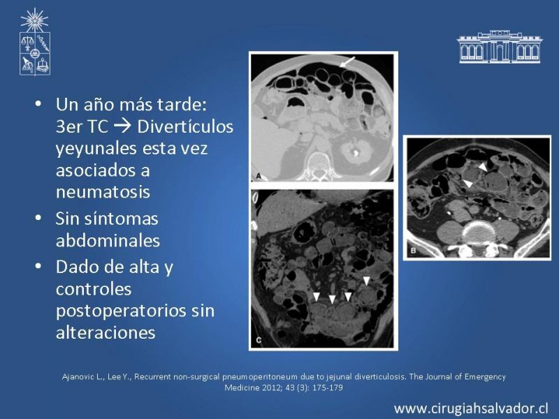 Diapositiva 43 de Caso Clínico