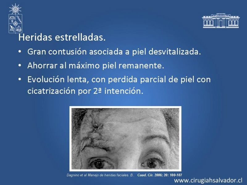 Diapositiva 23 de Trauma Facial: Manejo Quirúrgico de Partes Blandas  