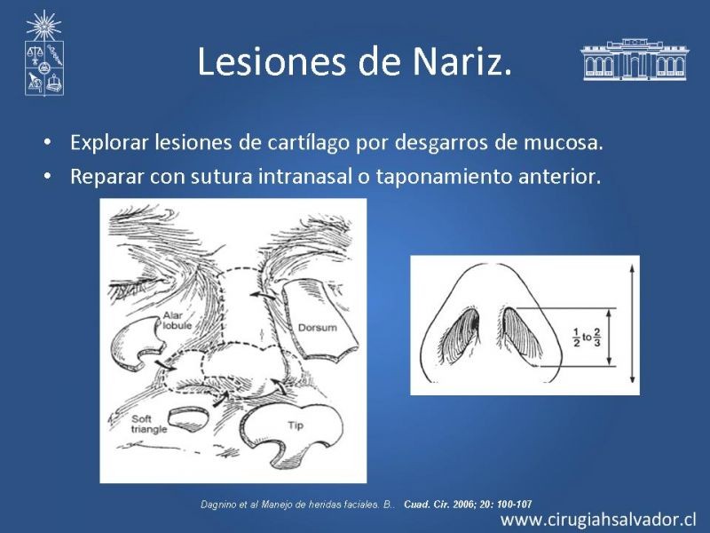 Diapositiva 40 de Trauma Facial: Manejo Quirúrgico de Partes Blandas  