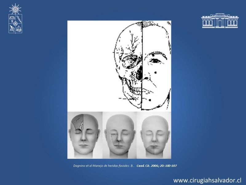 Diapositiva 21 de Trauma Facial: Manejo Quirúrgico de Partes Blandas  