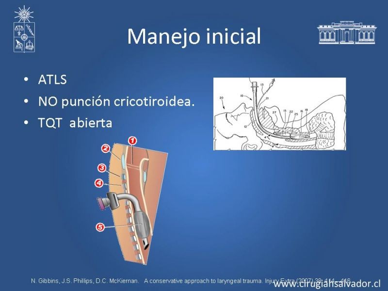 Diapositiva 6 de Manejo del trauma laríngeo