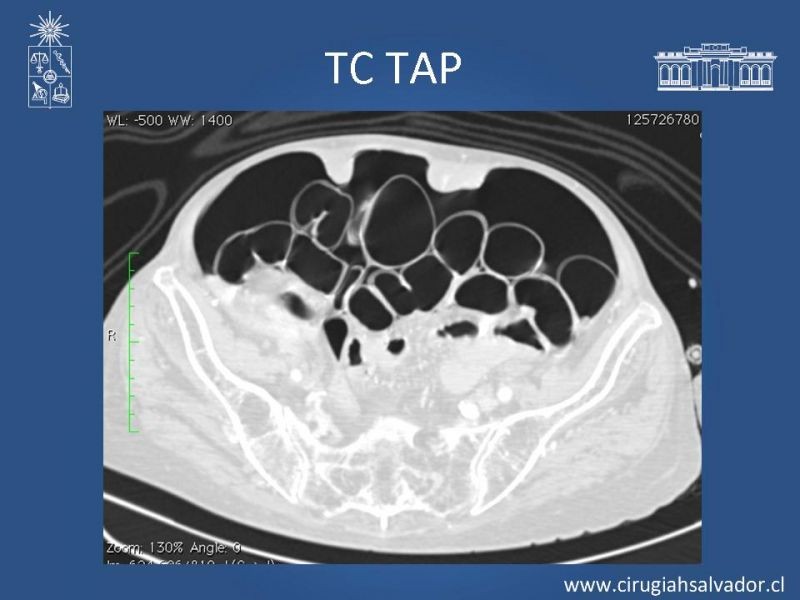 Diapositiva 6 de Caso Clínico