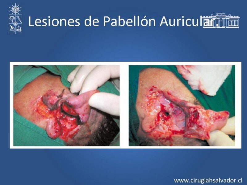 Diapositiva 37 de Trauma Facial: Manejo Quirúrgico de Partes Blandas  