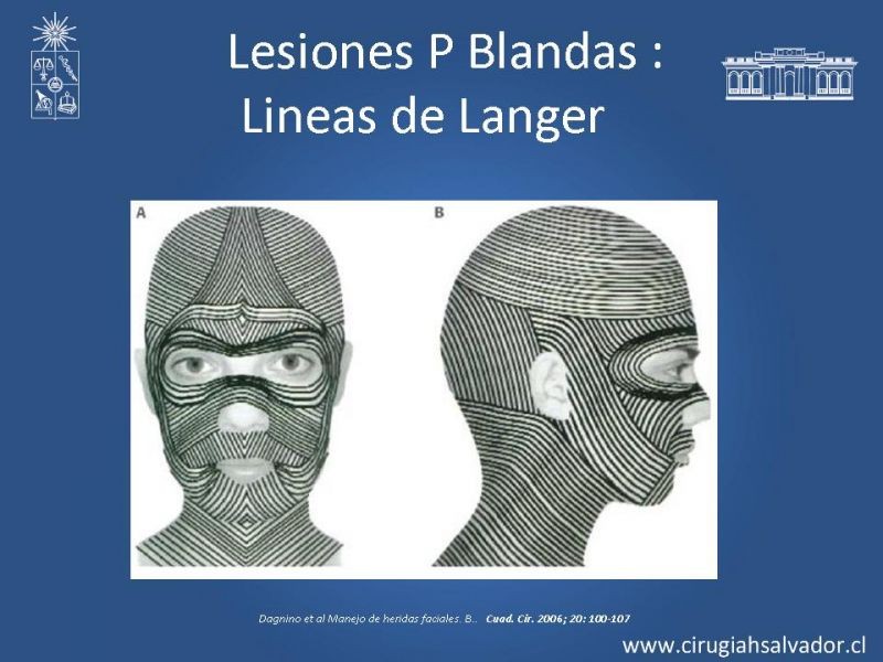 Diapositiva 16 de Trauma Facial: Manejo Quirúrgico de Partes Blandas  