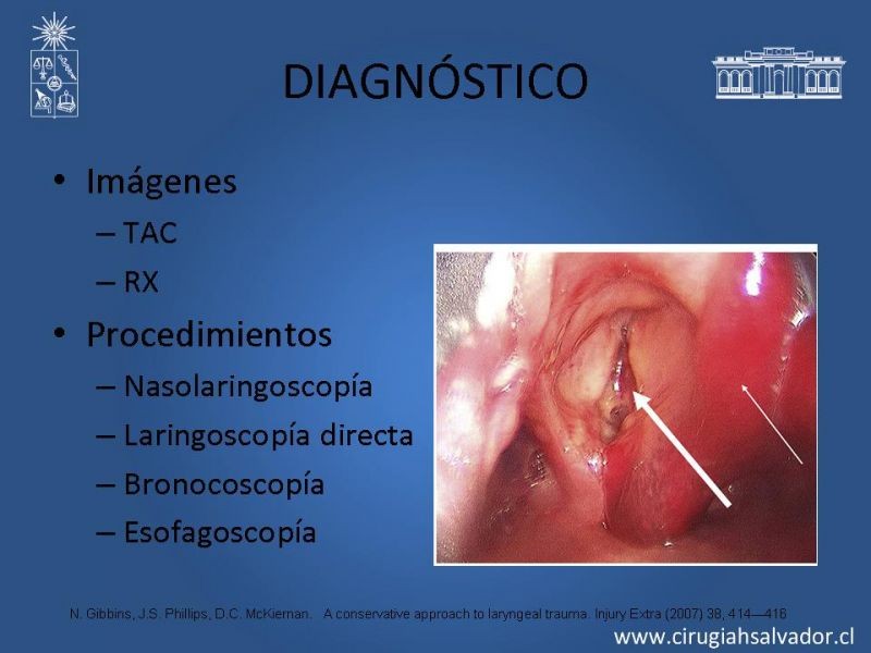 Diapositiva 8 de Manejo del trauma laríngeo