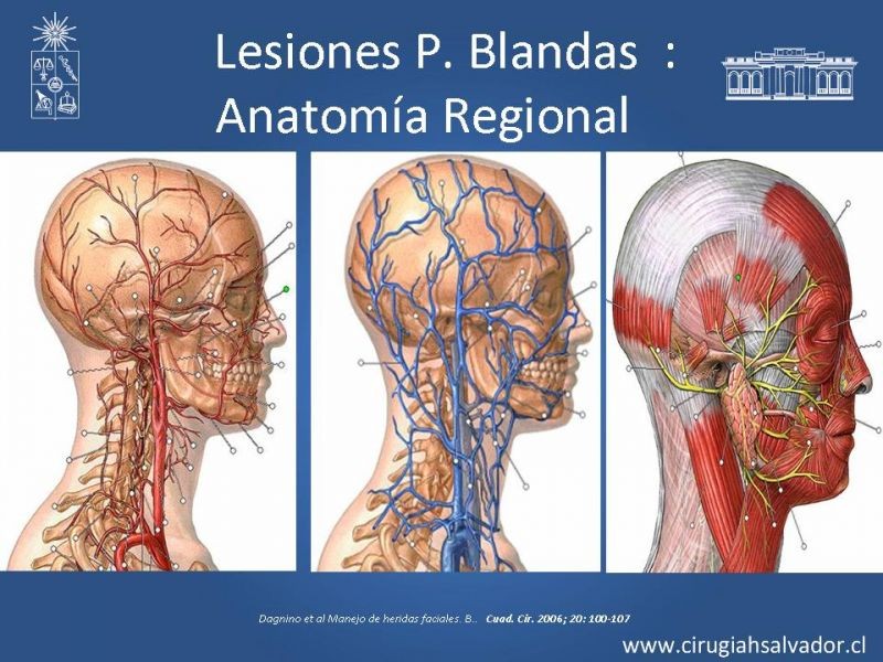 Diapositiva 15 de Trauma Facial: Manejo Quirúrgico de Partes Blandas  
