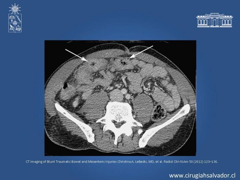 Diapositiva 18 de Imágenes en Trauma Abdominal 