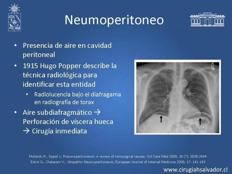 Diapositiva 17 de Caso Clínico