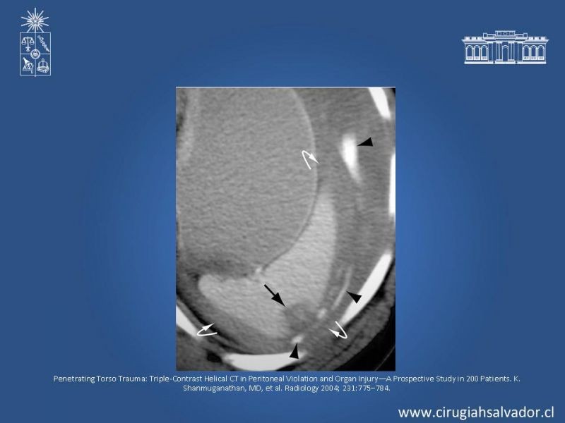 Diapositiva 10 de Imágenes en Trauma Abdominal 