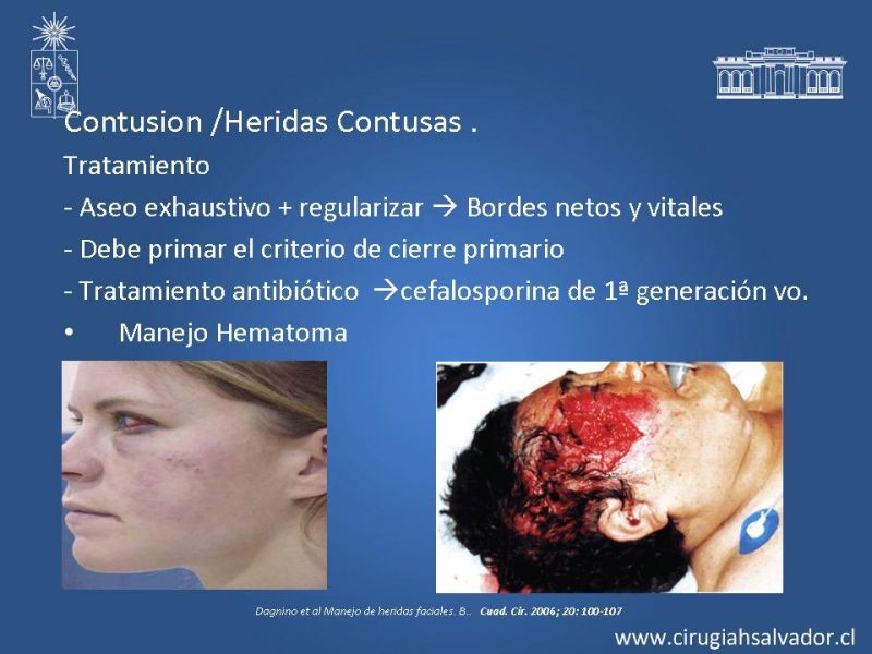 Diapositiva 19 de Trauma Facial: Manejo Quirúrgico de Partes Blandas  