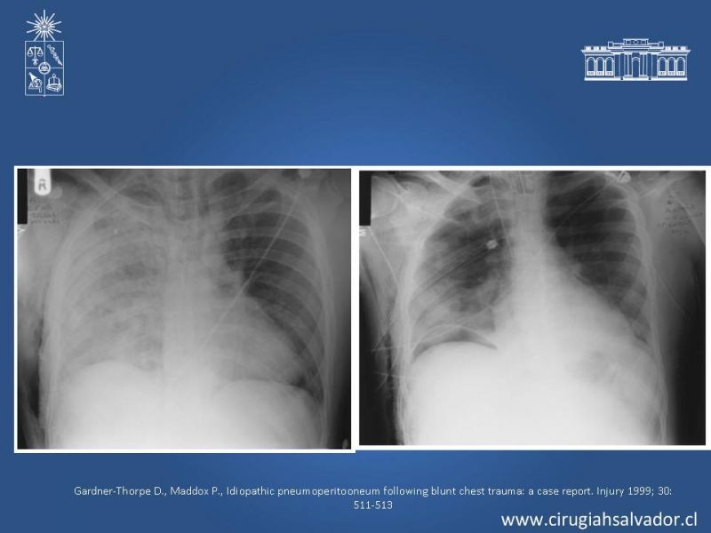 Diapositiva 34 de Caso Clínico