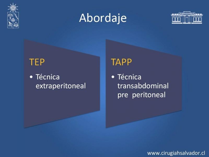 Diapositiva 5 de Hernioplastia Inguinal Laparoscópica
