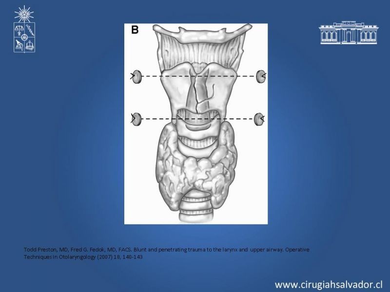 Diapositiva 18 de Manejo del trauma laríngeo