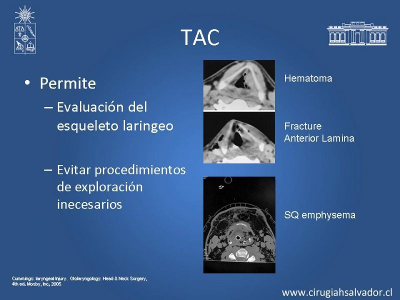 Diapositiva 9 de Manejo del trauma laríngeo