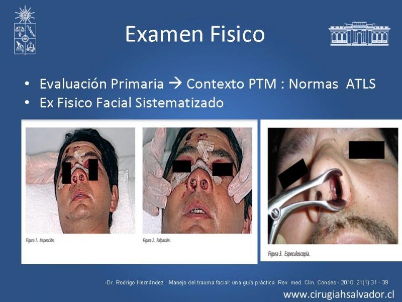 Diapositiva 4 de Trauma Facial: Manejo Quirúrgico de Partes Blandas  