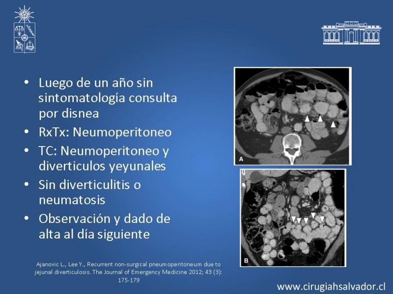 Diapositiva 42 de Caso Clínico