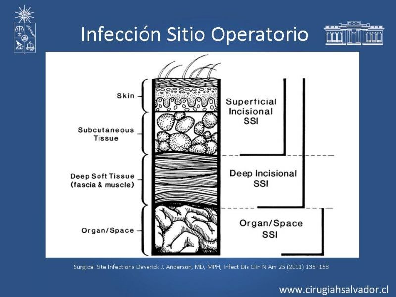 Diapositiva 8 de Armamentario ATB HDS: Indicaciones y usos