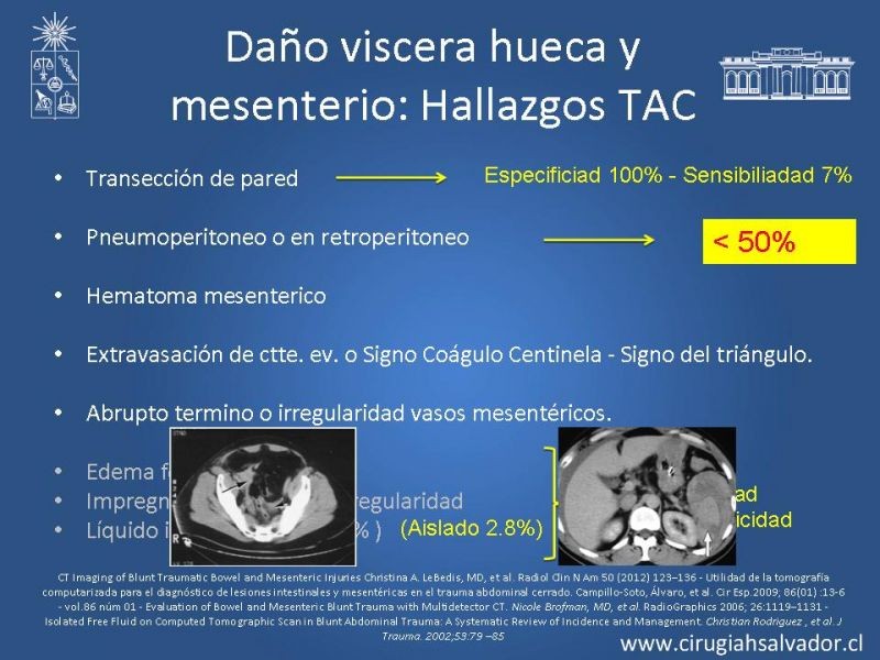 Diapositiva 16 de Imágenes en Trauma Abdominal 