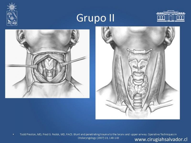 Diapositiva 14 de Manejo del trauma laríngeo