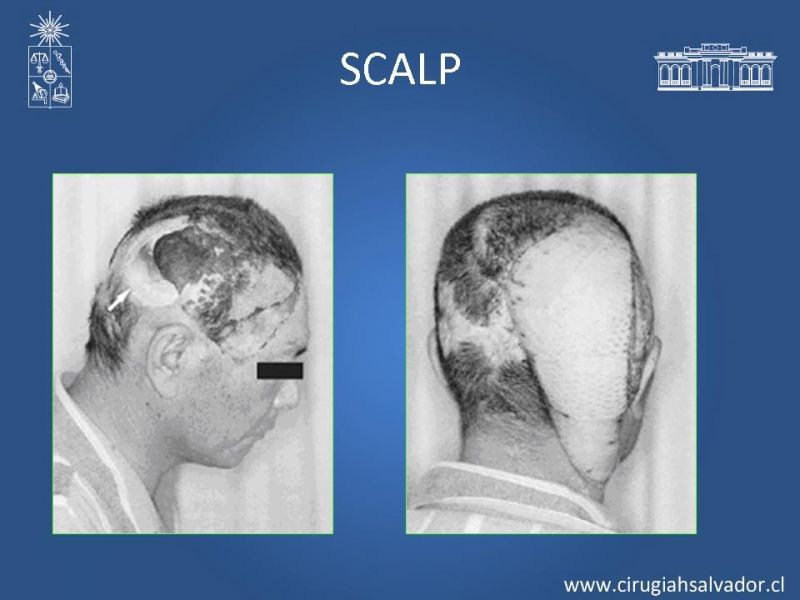 Diapositiva 27 de Trauma Facial: Manejo Quirúrgico de Partes Blandas  