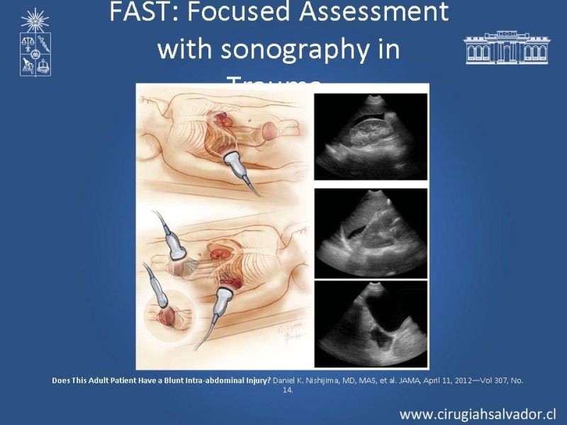 Diapositiva 6 de Imágenes en Trauma Abdominal 