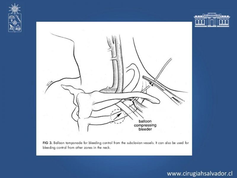 Diapositiva 13 de Manejo del trauma cervical penetrante