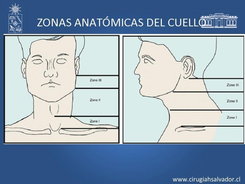 Diapositiva 6 de Manejo del trauma cervical penetrante