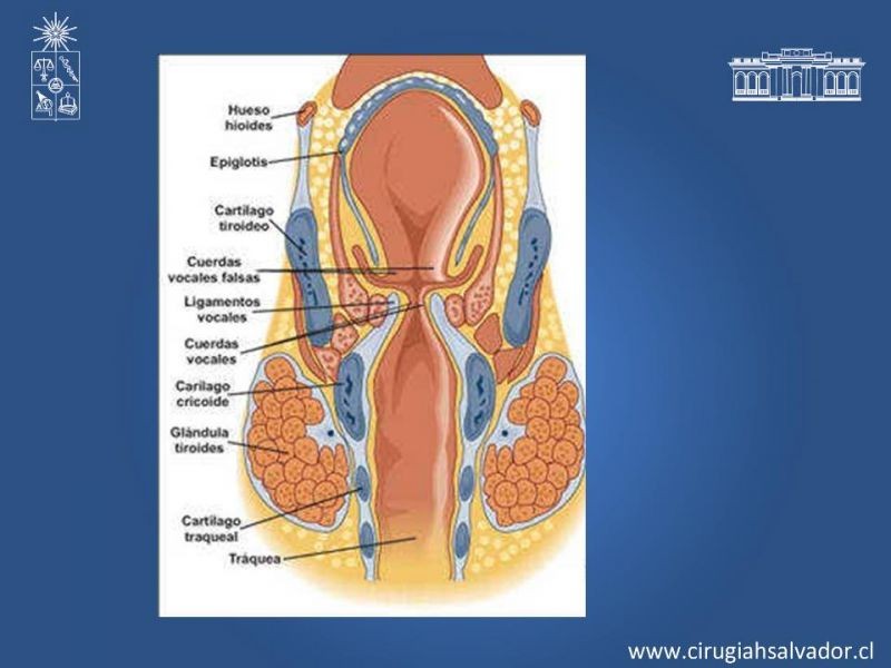 Diapositiva 2 de Manejo del trauma laríngeo