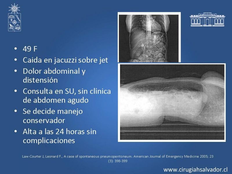 Diapositiva 38 de Caso Clínico